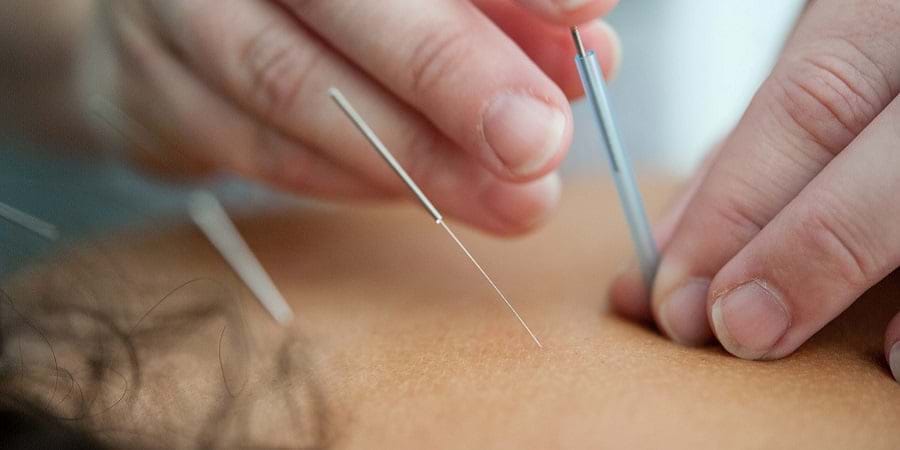 https://www.villageremedies.com/static/uploads/images/what-is-electro-acupuncture-wfsnpxpyimlr.jpg