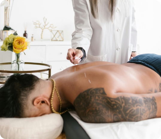 Person receiving acupuncture, a core practice in TCM, from a practitioner in a clinical setting.