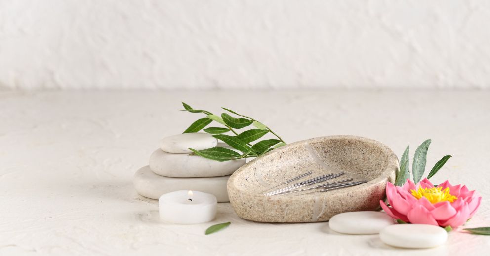 Acupuncture during pregnancy: needles rest in a dish with pebbles, candle, flower, and green leaves.