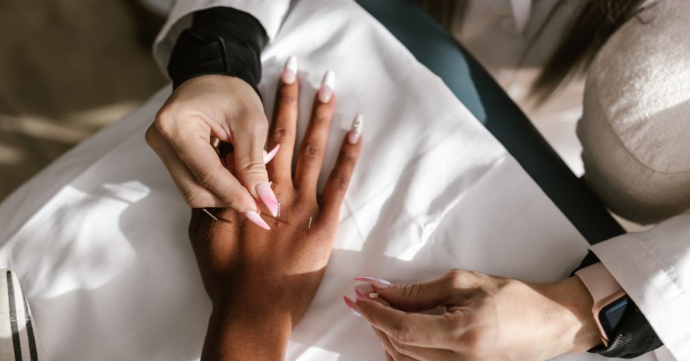 A practitioner targets acupuncture points for immediate stress relief in a patient’s hand.